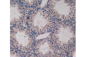 Used in DAB staining on fromalin fixed paraffin- embedded testis tissue (CXCL16 抗体  (AA 31-241))