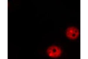 ABIN6267317 staining MOLT by IF/ICC. (Retinoblastoma 1 抗体  (pSer807))
