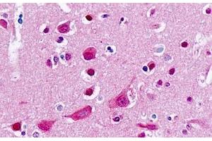 Immunohistochemistry (IHC) image for anti-Cytochrome P450, Family 2, Subfamily B, Polypeptide 6 (CYP2B6) (AA 241-290) antibody (ABIN2879260)