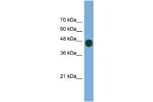 WB Suggested Anti-ARFGAP1 Antibody Titration: 0. (ARFGAP1 抗体  (Middle Region))