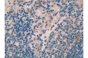 Immunohistochemistry (IHC) image for anti-Interleukin 18 (IL18) (AA 37-194) antibody (ABIN7429634)