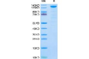 Klotho beta Protein (KLB) (AA 53-994) (His tag)