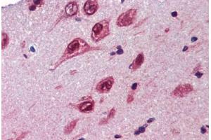 Human Brain, Cortex (formalin-fixed, paraffin-embedded) stained with UBQLN1 antibody ABIN462260 followed by biotinylated goat anti-rabbit IgG secondary antibody ABIN481713, alkaline phosphatase-streptavidin and chromogen. (Ubiquilin 1 抗体  (AA 290-339))