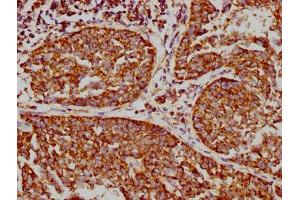 Immunohistochemistry (IHC) image for anti-Voltage-Dependent Anion Channel 1 (VDAC1) antibody (ABIN7127868)