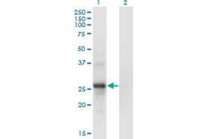 Western Blot analysis of SNF8 expression in transfected 293T cell line by SNF8 monoclonal antibody (M01), clone 6B11. (SNF8 抗体  (AA 23-122))