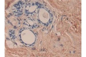 Immunohistochemistry (IHC) image for anti-Collagen, Type VI, alpha 3 (COL6a3) (AA 463-624) antibody (ABIN7434719)