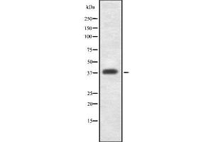 Western blot analysis GDF1 using K562 whole cell lysates (GDF1 抗体  (N-Term))