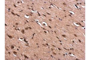 IHC-P Image AChE antibody detects AChE protein at nucleus on rat fore brain by immunohistochemical analysis. (Acetylcholinesterase 抗体  (C-Term))