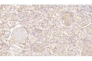 Detection of UBR4 in Human Spleen Tissue using Polyclonal Antibody to Ubiquitin Protein Ligase E3 Component N-Recognin 4 (UBR4) (UBR4 抗体  (AA 124-396))