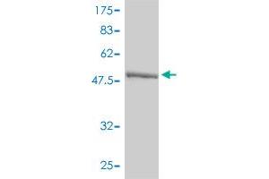 Western Blot detection against Immunogen (58. (Ketohexokinase 抗体  (AA 1-298))