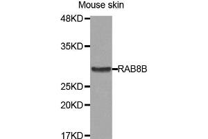 Western Blotting (WB) image for anti-RAB8B, Member RAS Oncogene Family (RAB8B) antibody (ABIN1875675) (RAB8B 抗体)