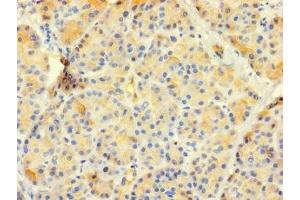Immunohistochemistry of paraffin-embedded human pancreatic tissue using ABIN7147746 at dilution of 1:100 (CTRB1 抗体  (AA 19-263))