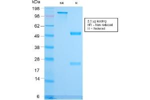 SDS-PAGE Analysis Purified CD79b Recombinant Rabbit Monoclonal Antibody (IGB/3170R). (Recombinant CD79b 抗体  (AA 29-159))