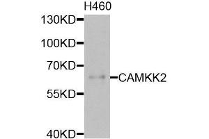 Western blot analysis of extracts of H460 cells, using CAMKK2 antibody (ABIN6003631) at 1/1000 dilution. (CAMKK2 抗体)