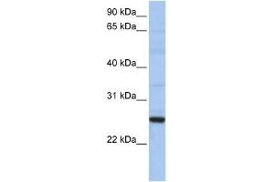 WB Suggested Anti-XBP1 Antibody Titration:  0. (XBP1 抗体  (N-Term))