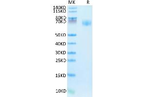 SDS-PAGE (SDS) image for Interferon gamma Receptor 1 (IFNGR1) (AA 18-245) protein (Fc Tag) (ABIN7274846)