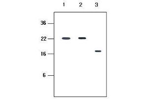 Human recombinant protein kIR2DL1, kIR2DL3 and kIR2DL4 (each 20ng per well) were resolved by SDS-PAGE, transferred to PVDF membrane and probed with anti-human kIR2D (1:500). (KIR2D 抗体  (AA 44-202))