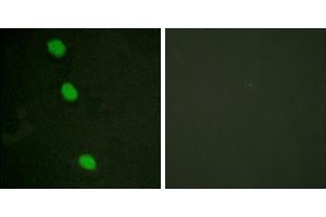 P-peptide - +Immunofluorescence analysis of HeLa cells, using CaMK4 (Phospho-Thr196/200) antibody. (CAMK4 抗体  (pThr196, pThr200))