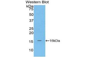 Western Blotting (WB) image for anti-Matrix Gla Protein (MGP) (AA 1-103) antibody (ABIN1859812)