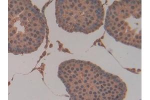 Immunohistochemistry (IHC) image for anti-Glutathione S-Transferase pi 1 (GSTP1) (AA 1-210) antibody (ABIN1078088)