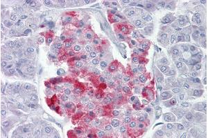 Immunohistochemistry (IHC) image for anti-Proprotein Convertase Subtilisin/kexin Type 1 (PCSK1) (Middle Region) antibody (ABIN2778153)