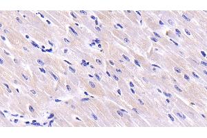 Detection of CSN3 in Bovine Cardiac Muscle Tissue using Polyclonal Antibody to Casein Kappa (CSN3) (CSN3 抗体  (AA 22-190))
