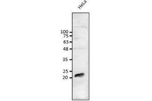Anti-Rab1b Ab at 1/1,000 dilution: lysates at 50 µg per Iane, rabbit polyclonal to goat (HRP) at 1/10,000 dilution, (RAB1B 抗体  (C-Term))