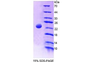 SDS-PAGE analysis of Rat MATK Protein. (MATK 蛋白)