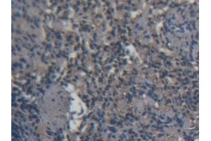 Immunohistochemistry (IHC) image for anti-CD3d Molecule, delta (CD3-TCR Complex) (CD3D) (AA 22-103) antibody (ABIN1175142)