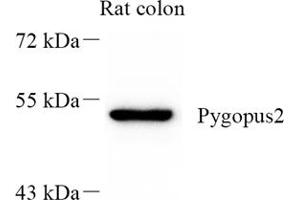 Western blot analysis of Pygopus2 (ABIN7075325) at dilution of 1: 300 (PYGO2 抗体)
