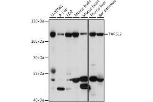 Western blot analysis of extracts of various cell lines, using T antibody (ABIN7270816) at 1:1000 dilution. (TARSL2 抗体  (AA 1-170))