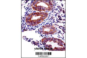 PHF16 Antibody immunohistochemistry analysis in formalin fixed and paraffin embedded human uterus tissue followed by peroxidase conjugation of the secondary antibody and DAB staining. (PHF16 抗体  (C-Term))