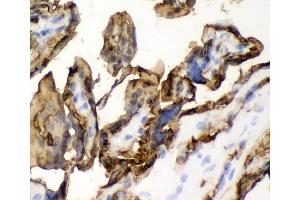 IHC analysis of SLC2A1 using anti-SLC2A1 antibody (ABIN3043927).