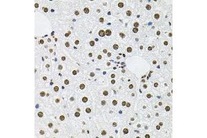 Immunohistochemistry of paraffin-embedded mouse liver using MCL1 antibody at dilution of 1:100 (x40 lens). (MCL-1 抗体)