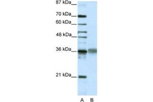 Western Blotting (WB) image for anti-T-Cell Leukemia Homeobox 2 (TLX2) antibody (ABIN2461873) (TLX2 抗体)
