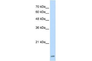UBE2I antibody used at 2.