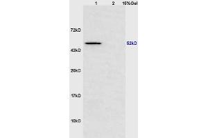 Lane 1: mouse heart lysates Lane 2: mouse brain lysates probed with Anti Scavenger Receptor BII Polyclonal Antibody, Unconjugated (ABIN873185) at 1:200 in 4 °C. (SCARB2 抗体  (AA 181-280))