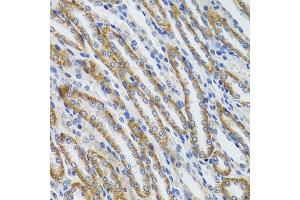 Immunohistochemistry of paraffin-embedded mouse kidney using HEXA antibody (ABIN6127519, ABIN6141730, ABIN6141732 and ABIN6216071) at dilution of 1:100 (40x lens). (Hexosaminidase A 抗体  (AA 270-529))