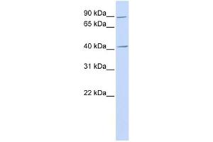USP18 antibody used at 1 ug/ml to detect target protein. (USP18 抗体  (N-Term))