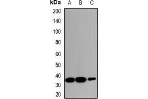 Western blot analysis of ZNT2 expression in HeLa (A), RAW264. (SLC30A2 抗体)