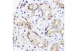 Immunohistochemistry of paraffin-embedded mouse salivary gland using RUNX2 Rabbit pAb (ABIN3016833, ABIN3016834, ABIN3016835 and ABIN6219851) at dilution of 1:100 (40x lens). (RUNX2 抗体  (AA 242-521))