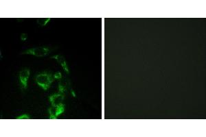 Peptide - +Immunohistochemistry analysis of paraffin-embedded human colon carcinoma tissue using Eif4g antibody.