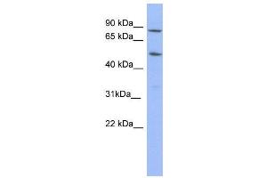 WB Suggested Anti-TRIM10  Antibody Titration: 0. (TRIM10 抗体  (N-Term))