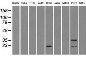 Western blot analysis of extracts (35 µg) from 9 different cell lines by using anti-CRYAB monoclonal antibody. (CRYAB 抗体)