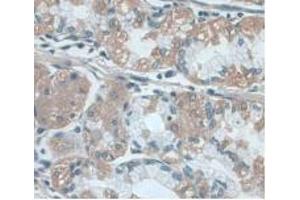 IHC-P analysis of Human Stomach Tissue, with DAB staining. (UCP2 抗体  (AA 154-289))