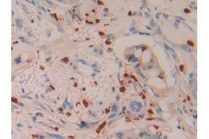 Immunohistochemistry (IHC) image for anti-Azurocidin 1 (AZU1) (AA 23-247) antibody (ABIN7433654)