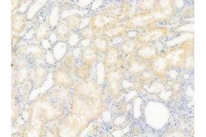 ABIN6261932 and ABIN6277595 at 1/100 staining human normal kidney tissue by IHC-P.
