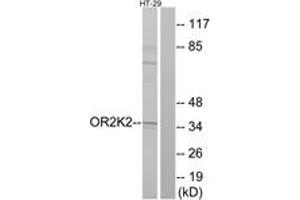 Western blot analysis of extracts from HT-29 cells, using OR2K2 Antibody. (OR2K2 抗体  (AA 241-290))