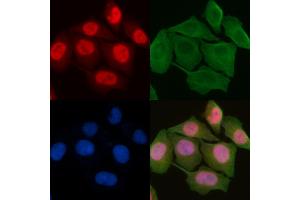 ABIN6259170 and ABIN6275473 staining Hela cells by IF/ICC. (RAB7L1 抗体  (Internal Region))