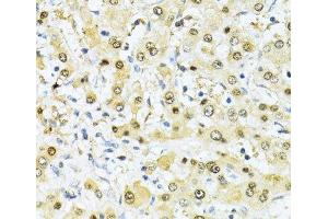 Immunohistochemistry of paraffin-embedded Human liver using ITGB3BP Polyclonal Antibody at dilution of 1:100 (40x lens). (ITGB3BP 抗体)
